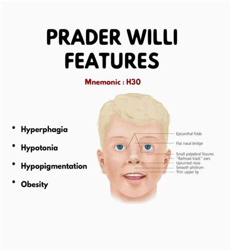 prada willis|prader willi syndrome symptoms.